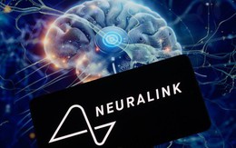 Vừa bình phục, người thứ hai cấy ghép Neuralink đã có thể chơi Counter-Strike bằng ý nghĩ và hạ vài đối thủ