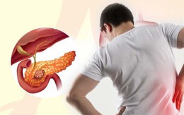 Chàng trai 29 tuổi bị đau lưng, BS nói chỉ còn sống được nửa năm, nguyên nhân do căn bệnh ung thư "giỏi ngụy trang"