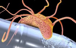 Vì sao sinh vật 'ăn nhựa' vẫn chưa thể cứu Trái Đất khỏi khủng hoảng rác thải?