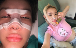 Ngân 98 lạm dụng phẫu thuật thẩm mỹ, hệ quả ra sao?