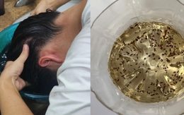 Lần đầu tiên sau 40 năm cuộc đời phát hiện: 9 sự "bá đạo" của giấm trắng