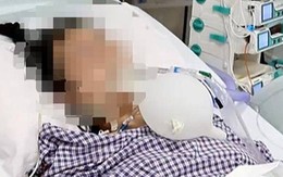 Người phụ nữ nguy kịch, suy hô hấp sau khi làm 1 việc để xóa nếp nhăn