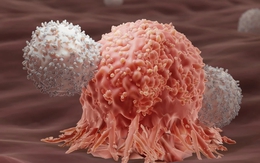 Tế bào ung thư biến mất hoàn toàn sau 5 tháng kiên trì làm 1 việc