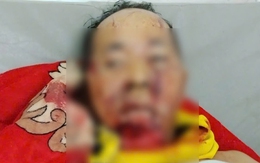 Trưởng thôn ở Đà Nẵng bị gấu rừng tấn công