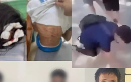 Từ đòn roi trong nhà đến ‘bạo lực biểu diễn’ trên TikTok: Trẻ em đang bị tổn thương ở mọi nơi