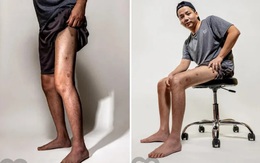 Tình trạng bất ổn của Khoa Pug