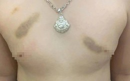 Phụ huynh tố giáo viên mầm non bạo hành trẻ, yêu cầu bồi thường 1 năm học phí?