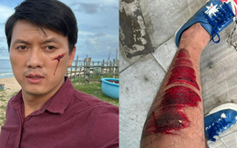 Quách Ngọc Tuyên bị tai nạn