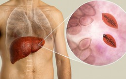 Chủ quán bất ngờ nhận tin gan bị tổn thương nặng vì chính món ăn mình bán mỗi ngày