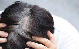 Thứ lá mọc đầy vườn, ai ngờ là 'thần dược' ngăn tóc bạc sớm