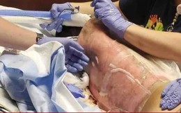 5 thử thách TikTok cực nguy hiểm, có một thử thách từng giết chết hơn 100 người