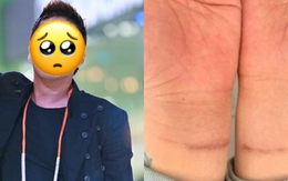 Sốc: Chủ nhân “bản hit quốc dân” cố tự tử