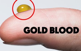 Nhóm máu 'quý hơn vàng', thế giới chỉ 50 người sở hữu