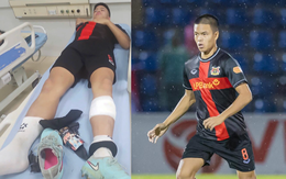 Cầu thủ Việt kiều giá 12 tỷ đồng phải nhập viện gấp sau khi lãnh trọn cú đạp tại trận đấu V.League