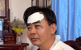 Tình trạng nghệ sĩ Chánh Thuận sau tai nạn xe