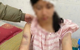 Bé gái bị gia đình nội tra tấn: Đây là hành vi nghiêm trọng