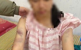 Mẹ bé gái bị bạo hành ở Thái Nguyên: Con bị đánh suốt 4 tiếng, dọa rút móng tay