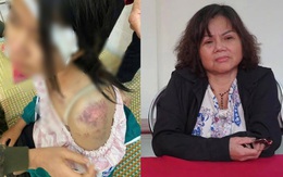 Hoàn cảnh cháu bé bị bà nội và 2 người đàn ông bạo hành: Bố mẹ ly hôn khi mới 1 tuổi, kể bị đánh 4 tiếng