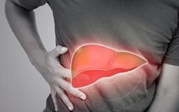 Mắc bệnh gan nhiễm mỡ vì thứ tưởng rằng "lành mạnh"