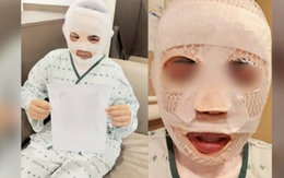 Vợ đang ngủ bị chồng tạt nước sôi vào mặt để huỷ dung vì sợ "gặp người đàn ông khác"