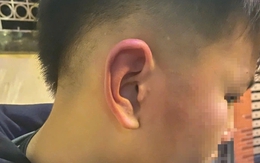 Phân định pháp lý vụ bé trai 12 tuổi bị bố bạn tát, đánh vào đầu