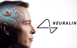 Công ty của Elon Musk cấy chip vào não người chỉ trong 1,5 giây, độ chính xác cực cao giúp tránh các mạch máu nhỏ