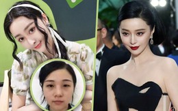 37 ca phẫu thuật, gần 30 tỷ đồng và cái kết cay đắng của người phụ nữ muốn trở thành Phạm Băng Băng thứ hai