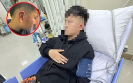Hà Nội: Bé trai 12 tuổi nghi bị bố của bạn tát, đánh đến choáng váng, hé lộ nguồn cơn