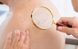 Đi khám da, bàng hoàng phát hiện nhiễm HIV: Tất cả chỉ vì 1 sai lầm của nhiều năm trước