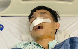 Công an khẩn trương vào cuộc vụ một người bị đánh gãy mũi ở Chợ đầu mối Hóc Môn