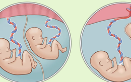 Bé trai nặng chưa đầy 1 kg được cứu sống thần kỳ