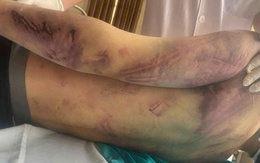 Tạm giữ 8 người liên quan đến vụ học viên 17 tuổi tử vong tại trung tâm công tác xã hội