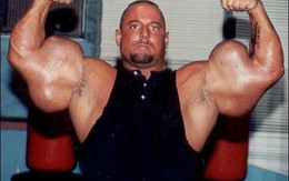 VĐV thể hình sở hữu “cánh tay quái dị” nhất thế giới, sự thật phía sau khiến tất cả ngỡ ngàng