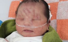 Bé sơ sinh bị vùi lấp ở Gia Lai chính thức được nhận nuôi