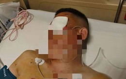 Khách rút tiền vật lộn với tên cướp 20 phút trước ngân hàng, bảo vệ bị tố mặc kệ