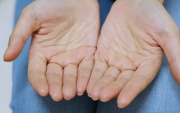 Nam giới mắc bệnh thận, thường xuyên ra mồ hôi ở 5 vị trí này