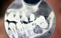 Người phụ nữ nhảy lầu tại bệnh viện sau khi bị nhổ nhầm răng khôn