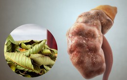 Xôn xao thông tin "người đàn ông suy thận độ 3 sau khi uống nước lá ổi": Chuyên gia nói gì?