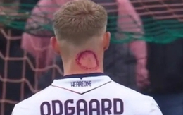 Vết đỏ bí ẩn xuất hiện sau gáy cầu thủ gây xôn xao