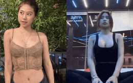Hậu phẫu thuật thẩm mỹ vòng 1, Louis Phạm lại muốn "đập đi xây lại" đôi chân, dân mạng vội khuyên can