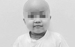 Bé Bắp qua đời sau thời gian "chiến đấu" với bệnh ung thư máu: Dấu hiệu rất dễ nhầm lẫn, điều cần biết để kịp thời phát hiện