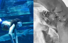 ‘Nàng tiên cá’ bị cá mập cắn tàn phế trong thủy cung