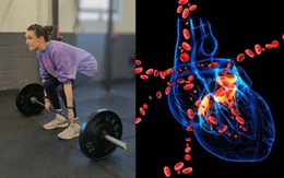Cô gái đang tập gym bỗng nghe tiếng "sủi bọt" trong cơ thể, bác sĩ chẩn đoán "chỉ còn 24 giờ để sống"