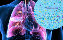 22 triệu hạt vi nhựa 'chui' vào cơ thể người bằng cách không ngờ tới: Làm ngay 7 điều để giảm nguy cơ