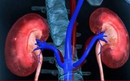 Dấu hiệu cảnh báo tổn thương thận cấp không nên bỏ qua
