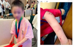 Vụ việc gây rúng động: Thần đồng cờ vây 9 tuổi nghi nhảy lầu tự tử, cộng đồng mạng bàng hoàng