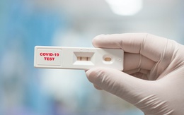 COVID-19 tăng trở lại: Có triệu chứng có cần test nhanh?