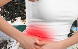 Sốc khi lấy ra 95 viên sỏi từ cơ thể người phụ nữ 40 tuổi, bác sĩ nhắc "bỏ ngay kiểu ăn ngủ này đi"