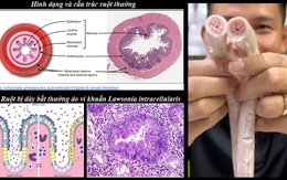 Tiến sĩ Việt tại Mỹ tiết lộ sự thật về lòng xe điếu, cảnh báo 3 nguy cơ