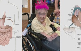Người phụ nữ sống khỏe mạnh 99 năm với nội tạng đảo ngược trong bụng: Những gì diễn ra trong phòng khám nghiệm thi thể gây chấn động